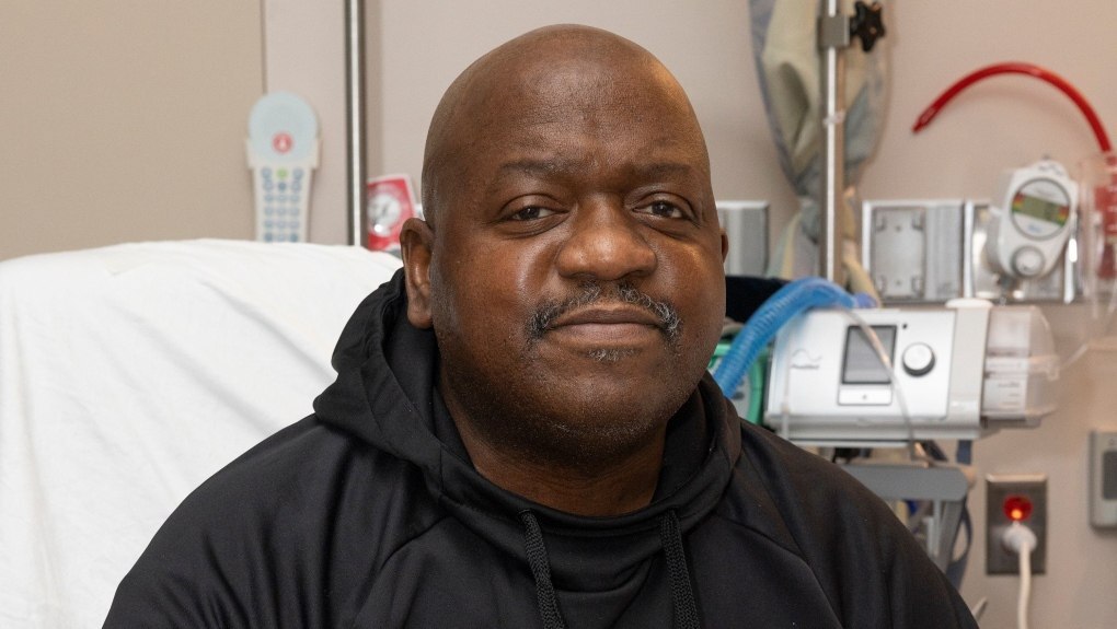 سرنوشت اولین بیماری که کلیه خوک پیوند زد مشخص شد/ عکس