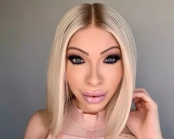 این زن بعد از هزینه ۵۰ هزار دلاری برای جراحی زیبایی، حالا پشیمان شده! این زن بعد از هزینه ۵۰ هزار دلاری برای جراحی زیبایی، حالا پشیمان شده!