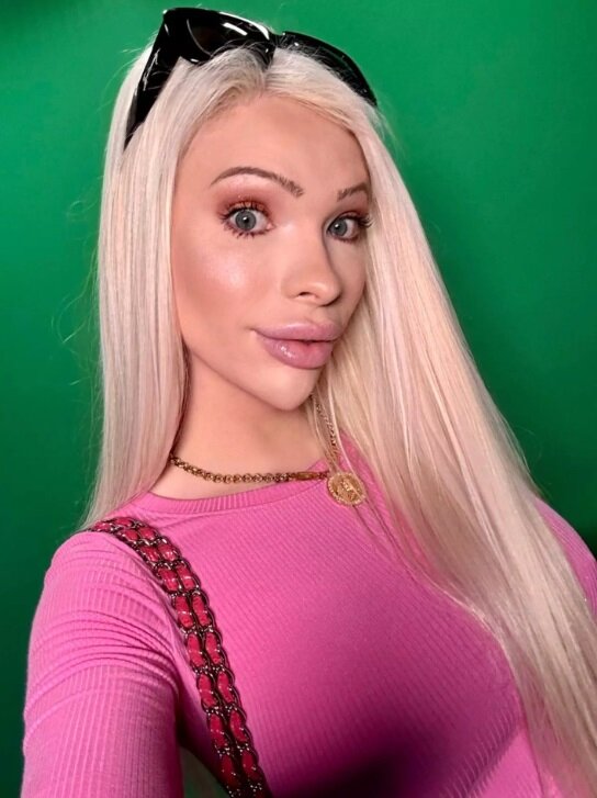 این زن بعد از هزینه ۵۰ هزار دلاری برای جراحی زیبایی، حالا پشیمان شده!