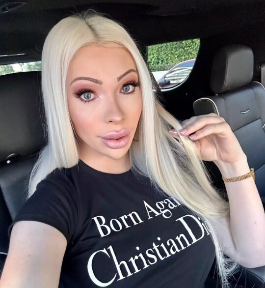 این زن بعد از هزینه ۵۰ هزار دلاری برای جراحی زیبایی، حالا پشیمان شده!