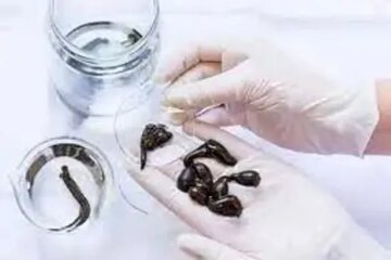 زالوی طبی را از کجا بخریم؟ زالوی طبی را از کجا بخریم؟