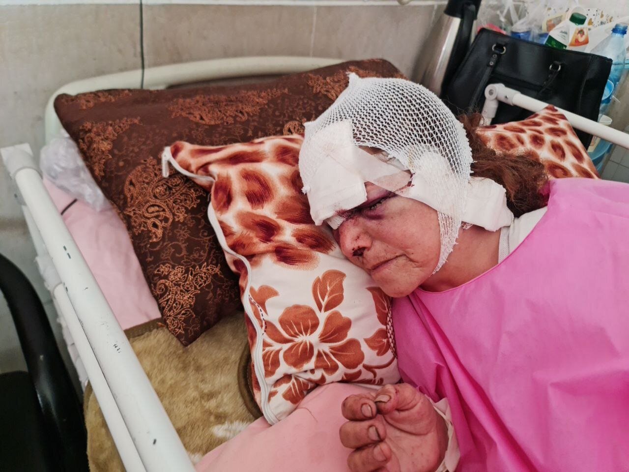 جدال زن 60 ساله و خرس در ارتفاعات پیرانشهر / روایت ماجرا از زبان پسرش + تصویر دلخراش زن در بیمارستان 2