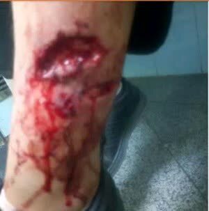 تصاویر دلخراش از حمله سگ‌های ولگرد به یک دختر دانش‌آموز | عکس 2