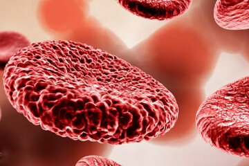 مهمترین نشانههای کم خونی چیست؟/ چه بخوریم کمخونی را جبران کند مهمترین نشانههای کم خونی چیست؟/ چه بخوریم کمخونی را جبران کند