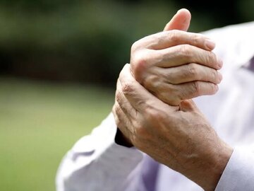 تشخیص یک بیماری از روی دستها تشخیص یک بیماری از روی دستها