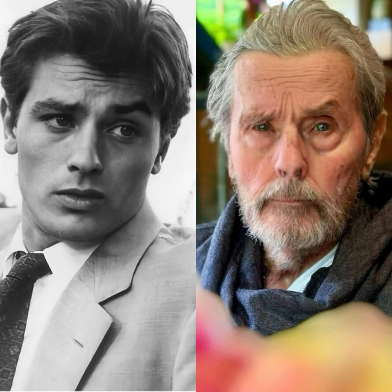 عکس | تصویری غافلگیرکننده از چهره شکسته شده «آلن دلون»