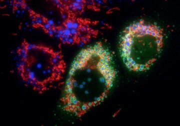 گام بلند دانشمندان در درمان سرطان/ لیپیدها زیر ذرهبین میروند! گام بلند دانشمندان در درمان سرطان/ لیپیدها زیر ذرهبین میروند!