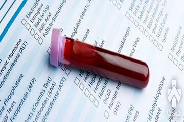 شناسایی ۳ نوع سرطان با یک قطره خون