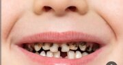 بیماری‌های دهان و دندان و عدم پوشش بیمه ها در این اصل مهم سلامتی!؟