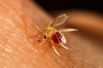 بیماریی که سالانه بین هزار تا دو هزار نفر به آن مبتلا میشوند بیماریی که سالانه بین هزار تا دو هزار نفر به آن مبتلا میشوند