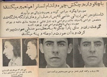 یک بانو که بینی طویل و قوزداری داشت.../ اولین تبلیغات جراحی بینی/ عکس یک بانو که بینی طویل و قوزداری داشت.../ اولین تبلیغات جراحی بینی/ عکس
