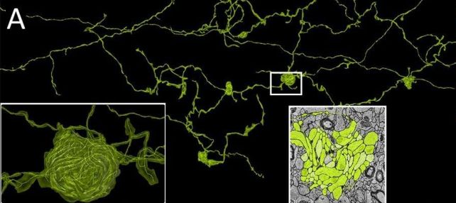 ثبت جزئیترین تصویر از مغز انسان/ داخل مغز بیمار مبتلا به صرع چه خبر است؟/ عکس