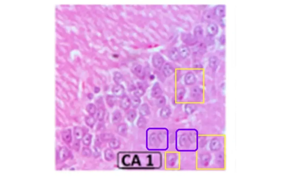 تصویر بزرگتر از بافت مغز