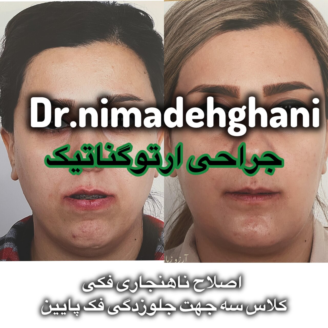 متخصص جراحی های دهان، فک و صورت