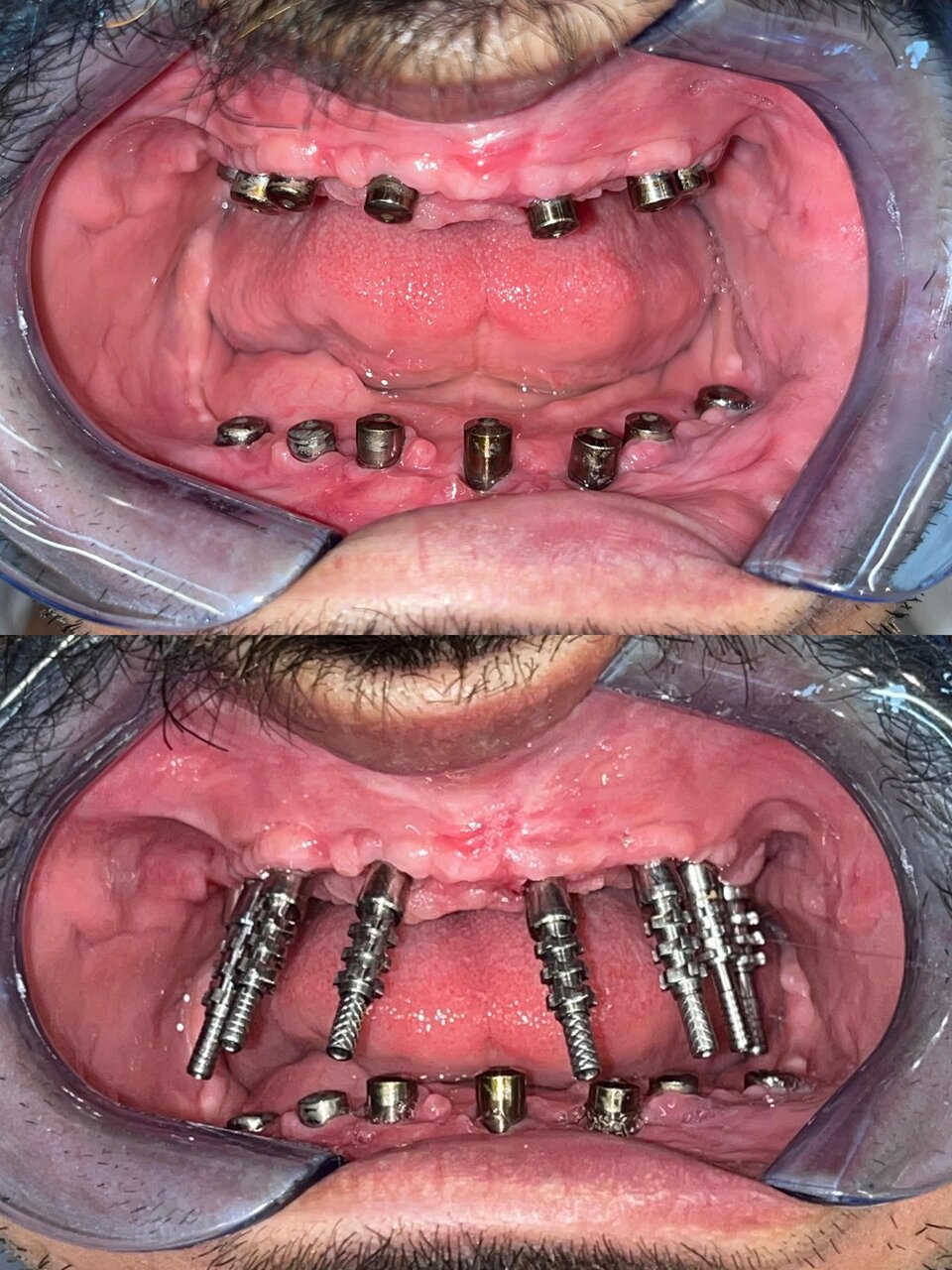 متخصص جراحی های دهان، فک و صورت