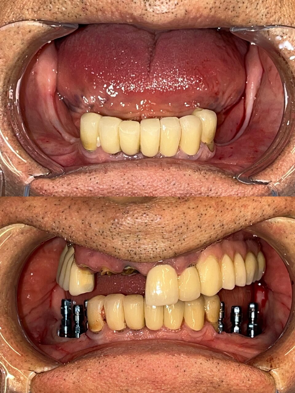 متخصص جراحی های دهان، فک و صورت