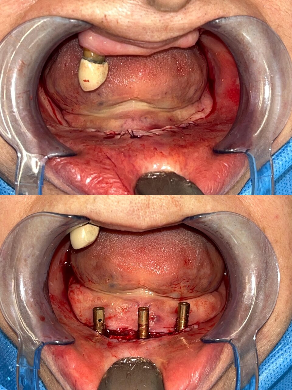 متخصص جراحی های دهان، فک و صورت