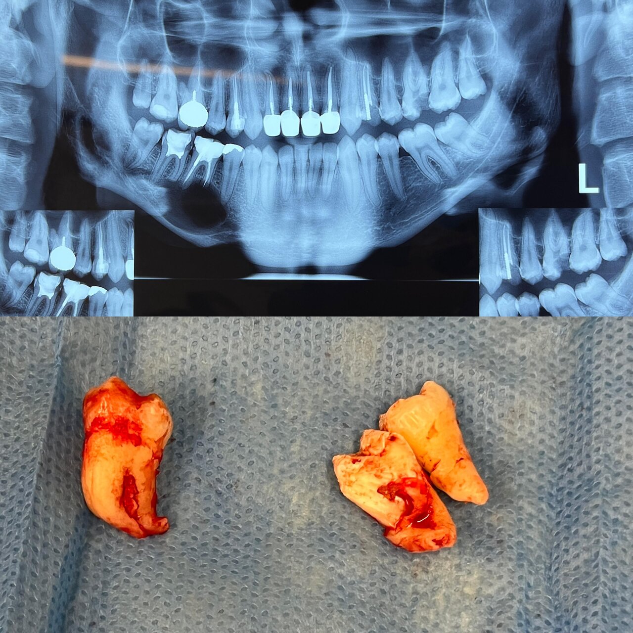 متخصص جراحی های دهان، فک و صورت