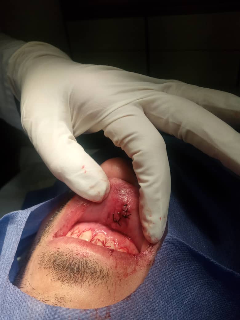 عکس| کار مدافع استقلالی به اتاق عمل کشید