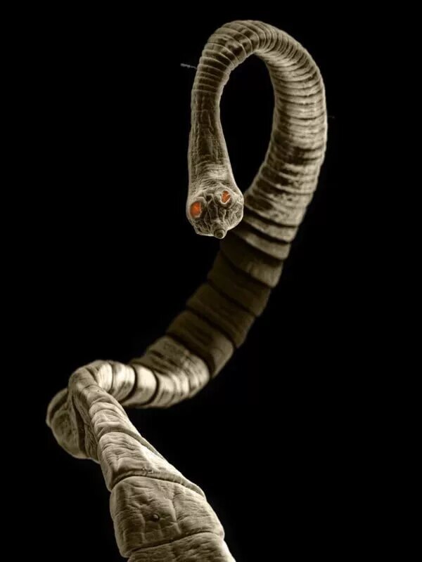 کرم نواری دیپیلیدیم
 کرم نواری دیپیلیدیم