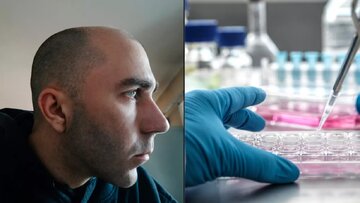 دیگر کسی در آینده تاس نمیشود/ دانشمندان در یک قدمی درمان دیگر کسی در آینده تاس نمیشود/ دانشمندان در یک قدمی درمان