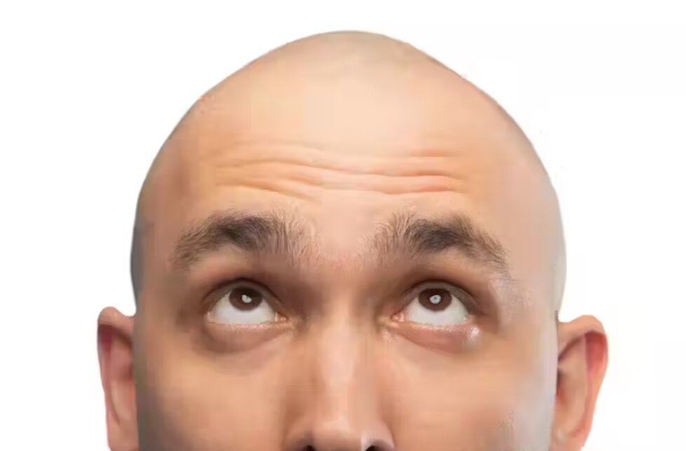 دیگر کسی در آینده تاس نمیشود/ دانشمندان در یک قدمی درمان