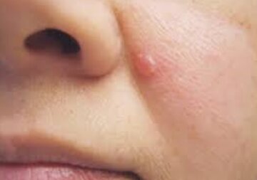 مشاهده این نشانه در بدن را جدی بگیرید مشاهده این نشانه در بدن را جدی بگیرید