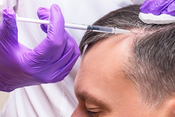 ۴ تا از بهترین برندهای هیر فیلر که باید بشناسید! ✔️