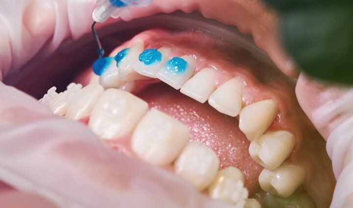 ببینید | شوکه شدن دندان‌پزشک از اقدام عجیب یک مرد برای جلوگیری از افتادن دندان‌هایش