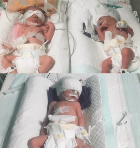 تولد سه قلوها در بیمارستان بعثت سنندج