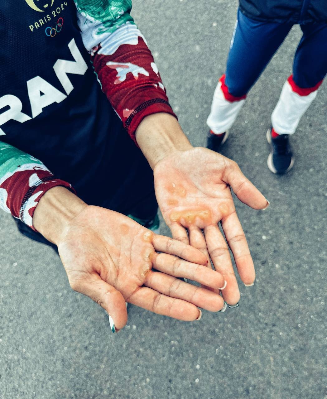 عکس | به این دستها باید مدال المپیک داد!