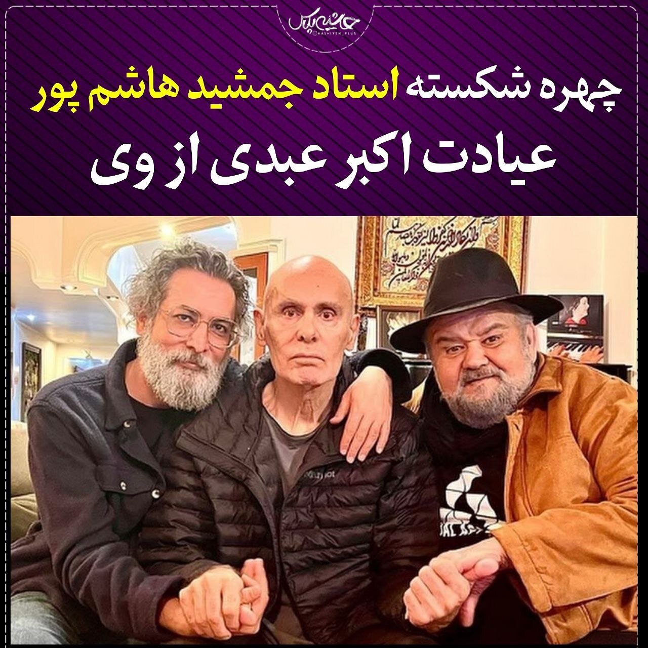 عکس | تصویری تلخ از چهره شکسته جمشید هاشم‌پور در کنار اکبر عبدی