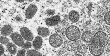 سویه خطرناکتر «آبله میمونی» در چه کشورهایی شناسایی شده است؟ سویه خطرناکتر «آبله میمونی» در چه کشورهایی شناسایی شده است؟