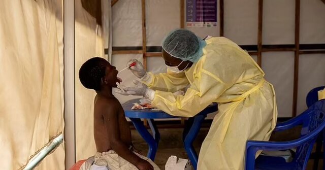 آبله میمون؛ خطری در کمین سلامت جهانی/ بیش از ۱۶ هزار مبتلا در بیش از ۷۵ کشور جهان/ آیا کار به قرنطینه و پاندمی میرسد؟/ مرگ و میر در کودکان بیشتر است