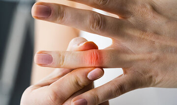 درد مفاصل؟ شاید بدن شما فقط این ویتامینها را کم دارد درد مفاصل؟ شاید بدن شما فقط این ویتامینها را کم دارد