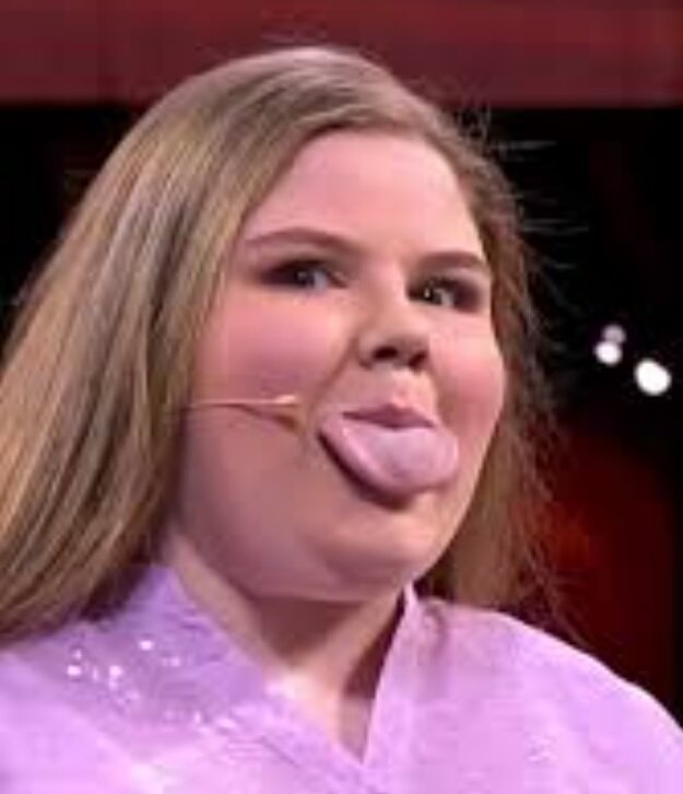 وحشت نکنید! این زن صاحب پهنترین زبان دنیاست/ عکس