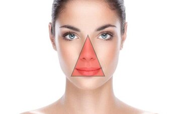 مثلث مرگ در صورت چیست؟ مثلث مرگ در صورت چیست؟