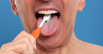 چرا باید زبان را مسواک زد؟ چرا باید زبان را مسواک زد؟