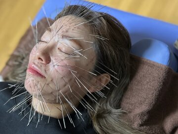 عجیب و غریب؛ روش جدید استفاده از طب سوزنی در ژاپن/ عکس عجیب و غریب؛ روش جدید استفاده از طب سوزنی در ژاپن/ عکس