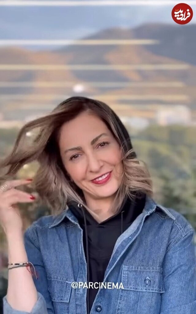 تغییر چهره خانم شیرزاد ساختمان پزشکان در ۴۵ سالگی/ عکس
