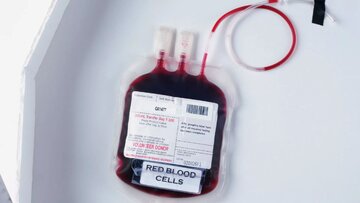 کشف یک گروه خونی جدید بعد از ۵۰ سال کشف یک گروه خونی جدید بعد از ۵۰ سال