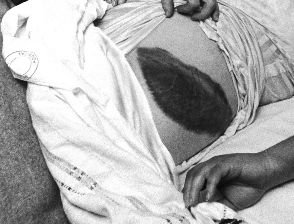 اولین زنی که ضربه شهابسنگ را تجربه کرد!/ عکس