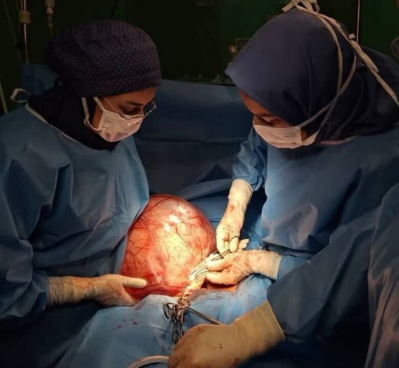 توده ۱۱ کیلویی در شکم زن ۲۶ ساله کرمانشاهی؛ این زن فکر میکرد چاق شده!/ عکس