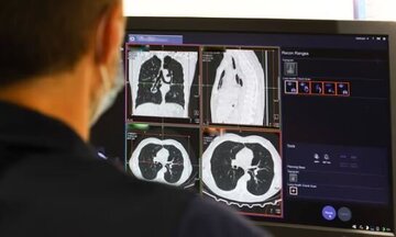 کشف دارویی جدید برای یک سرطان مهم کشف دارویی جدید برای یک سرطان مهم