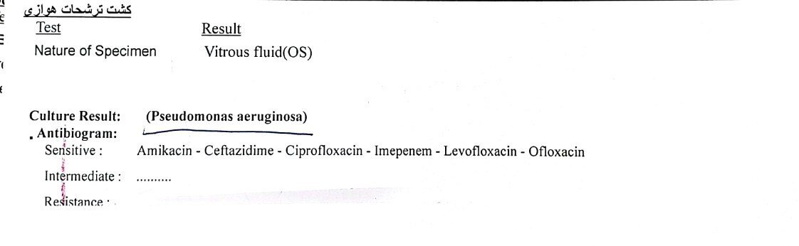 بیمارستان چشمپزشکی شمال تهران بینایی ۲ بیمار را گرفت!