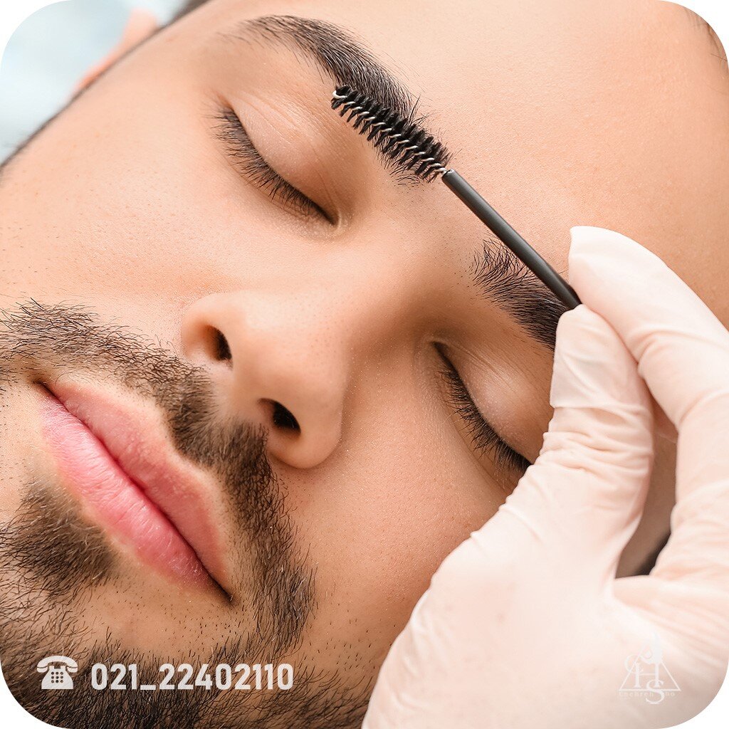 کاشت ابرو برای مردان