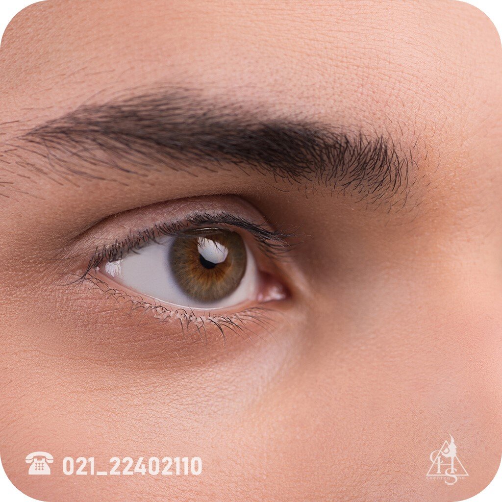 کاشت ابرو برای مردان