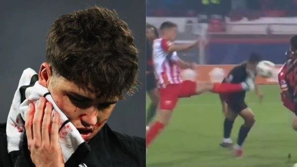 عکس | وضعیت ناراحتکننده پدیده بارسا با 10 بخیه!