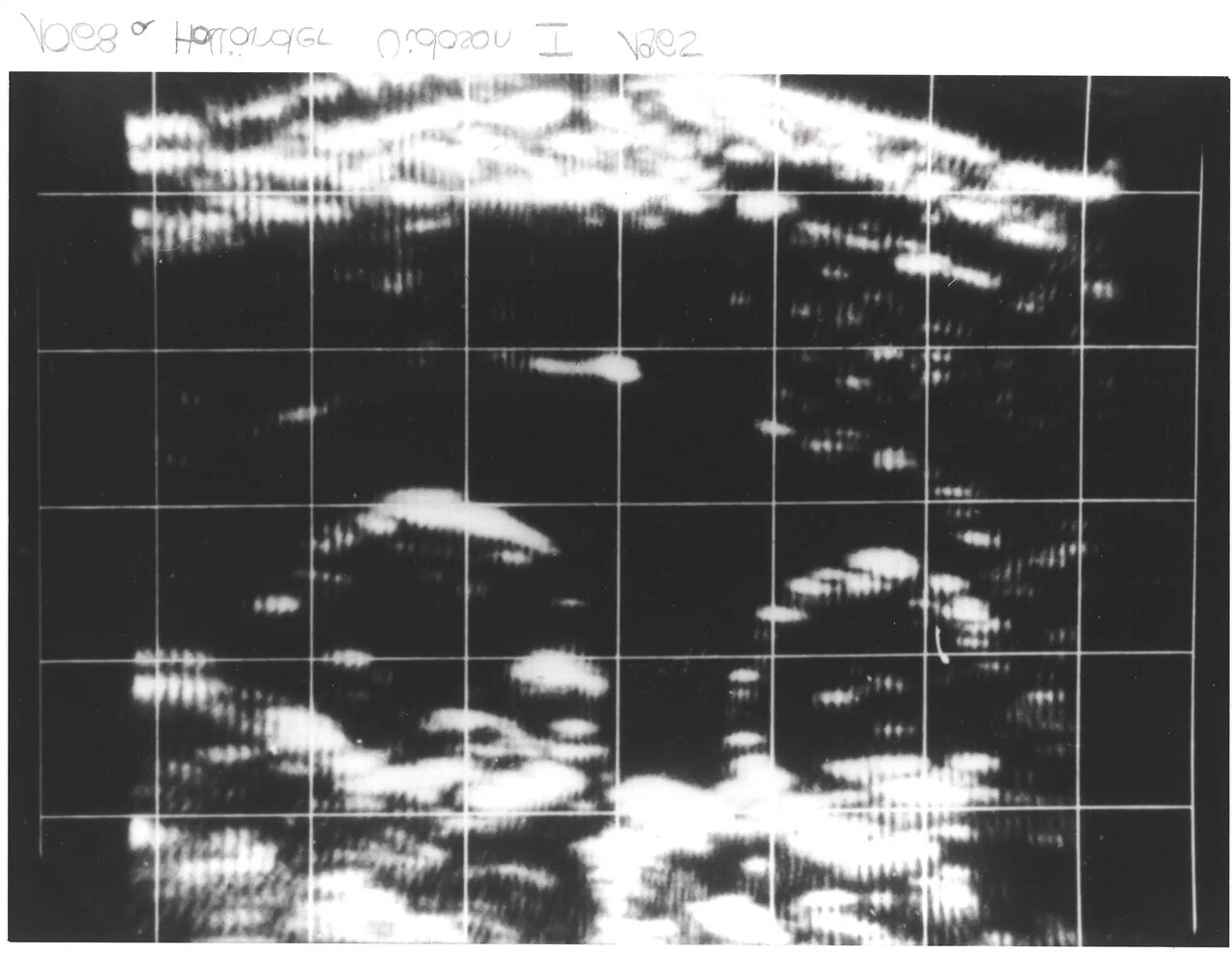 «سونوگرافی» چگونه کشف شد؟/ تصاویری از دستگاههای سونوگرافی در گذشت زمان