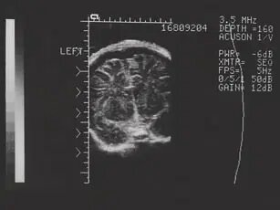 «سونوگرافی» چگونه کشف شد؟/ تصاویری از دستگاههای سونوگرافی در گذشت زمان